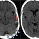 A picture of the same brain with different colors.