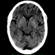 A black and white image of a brain with the words " neurofeedback ".